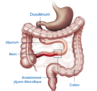 Anastomose jéjuno-iléocolique avec la valvule iléo-cæcale et le colon complet en continuité